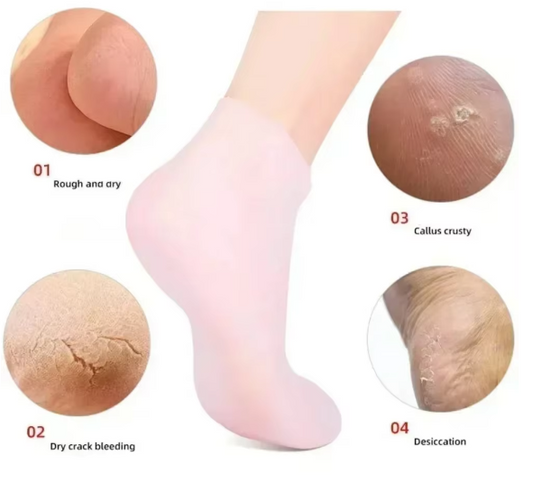Silicone Moisturiser Sock
