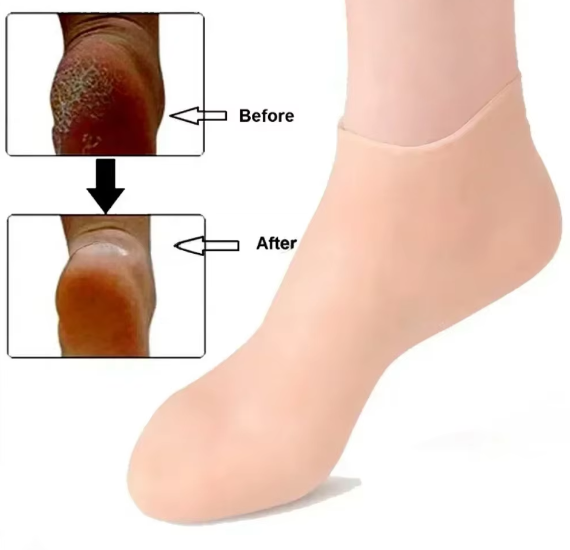 Silicone Moisturiser Sock