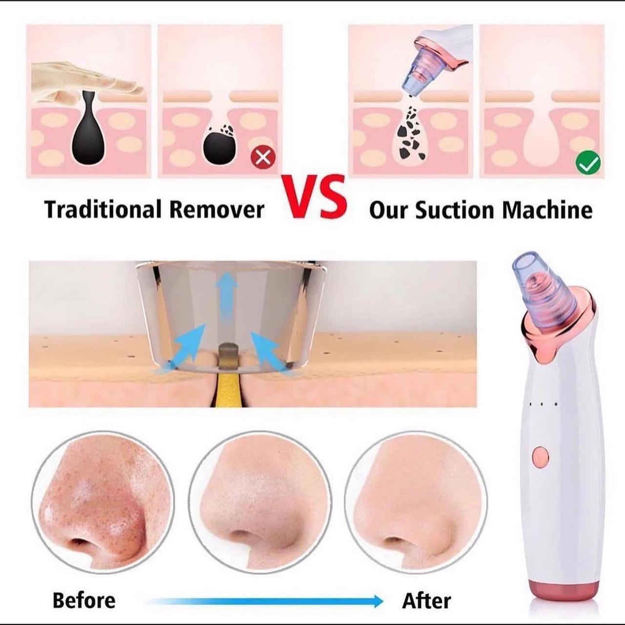 Blackhead Suction Machine